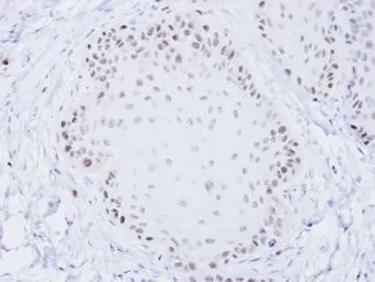Anti-BLM antibody [C3], C-term used in IHC (Paraffin sections) (IHC-P). GTX101303