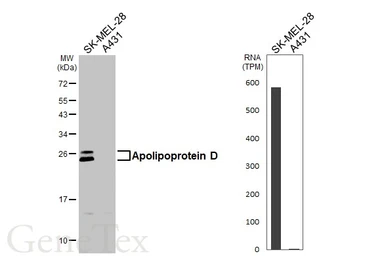 Anti-Apolipoprotein D antibody used in Western Blot (WB). GTX101306