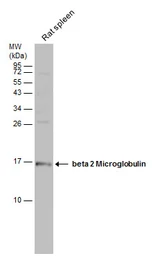 Anti-beta 2 Microglobulin antibody [N1C3] used in Western Blot (WB). GTX101314
