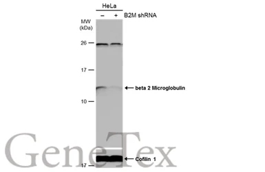 Anti-beta 2 Microglobulin antibody [N1C3] used in Western Blot (WB). GTX101314