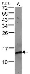 Anti-beta 2 Microglobulin antibody [N1C3] used in Western Blot (WB). GTX101314