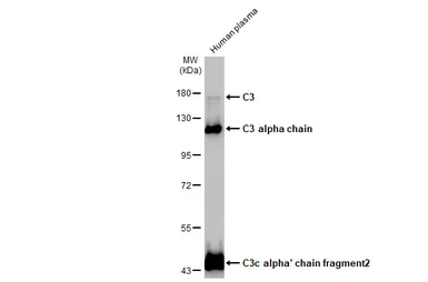 Anti-C3 / C3b antibody [C3], C-term used in Western Blot (WB). GTX101316