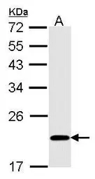Anti-Bid antibody [N1C3] used in Western Blot (WB). GTX101323