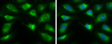 Anti-ASS1 antibody used in Immunocytochemistry/ Immunofluorescence (ICC/IF). GTX101325