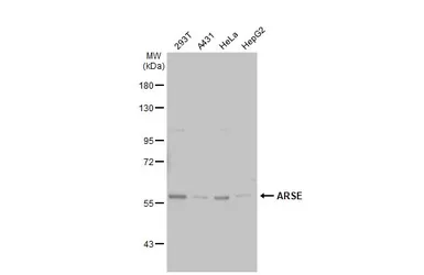 Anti-ARSE antibody [C2C3], C-term used in Western Blot (WB). GTX101335