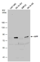 Anti-APP antibody [C2C3], C-term used in Western Blot (WB). GTX101336
