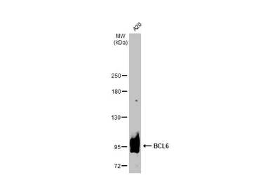 Anti-BCL6 antibody [N2C1], Internal used in Western Blot (WB). GTX101338