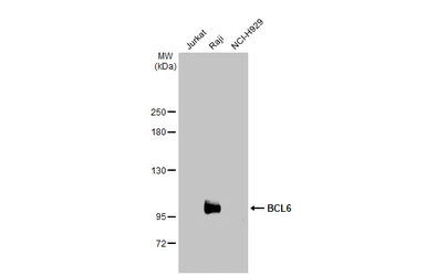 Anti-BCL6 antibody [N2C1], Internal used in Western Blot (WB). GTX101338