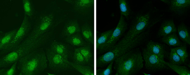 Anti-Ataxin 3 antibody used in Immunocytochemistry/ Immunofluorescence (ICC/IF). GTX101343