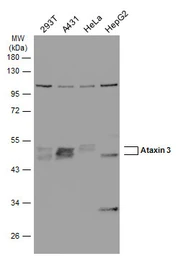 Anti-Ataxin 3 antibody used in Western Blot (WB). GTX101343