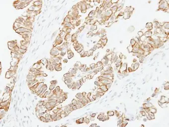 Anti-Adenylate cyclase 2 antibody [N3C1], Internal used in IHC (Paraffin sections) (IHC-P). GTX101360