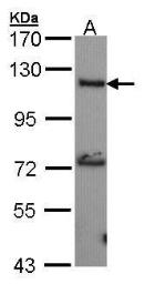 Anti-Adenylate cyclase 2 antibody [N3C1], Internal used in Western Blot (WB). GTX101360