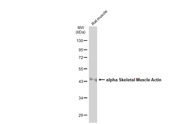 Anti-alpha Skeletal Muscle Actin antibody used in Western Blot (WB). GTX101362