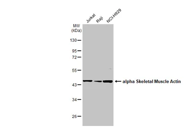 Anti-alpha Skeletal Muscle Actin antibody used in Western Blot (WB). GTX101362