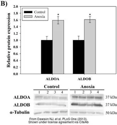 Anti-Aldolase B antibody used in Western Blot (WB). GTX101363