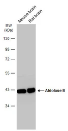 Anti-Aldolase B antibody used in Western Blot (WB). GTX101363