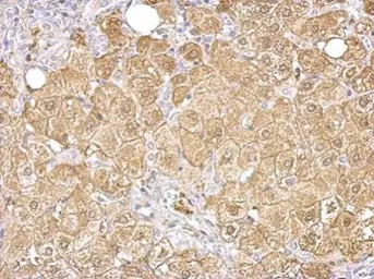 Anti-Aldolase B antibody used in IHC (Paraffin sections) (IHC-P). GTX101363