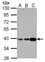 Anti-Aldolase B antibody used in Western Blot (WB). GTX101363
