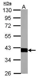 Anti-Aldolase B antibody used in Western Blot (WB). GTX101363