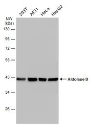 Anti-Aldolase B antibody used in Western Blot (WB). GTX101363