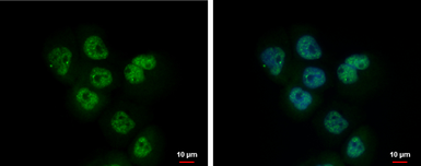 Anti-Adenosine kinase antibody [N1C1] used in Immunocytochemistry/ Immunofluorescence (ICC/IF). GTX101372