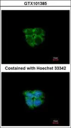 Anti-Adenosine kinase antibody used in Immunocytochemistry/ Immunofluorescence (ICC/IF). GTX101385