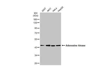 Anti-Adenosine kinase antibody used in Western Blot (WB). GTX101385