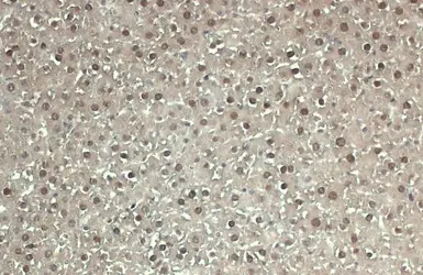 Anti-Adenosine kinase antibody used in IHC (Paraffin sections) (IHC-P). GTX101385