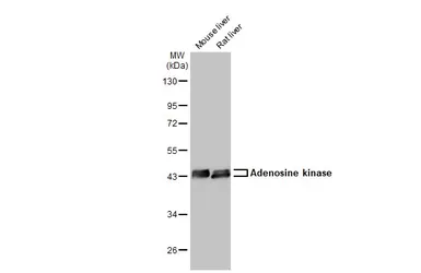 Anti-Adenosine kinase antibody used in Western Blot (WB). GTX101385