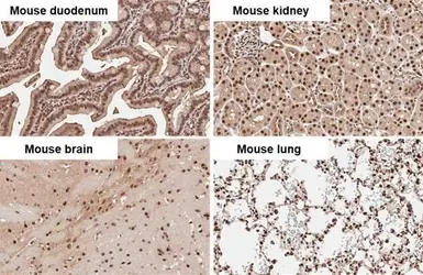Anti-Adenosine kinase antibody used in IHC (Paraffin sections) (IHC-P). GTX101385