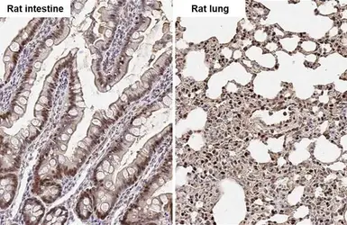 Anti-Adenosine kinase antibody used in IHC (Paraffin sections) (IHC-P). GTX101385
