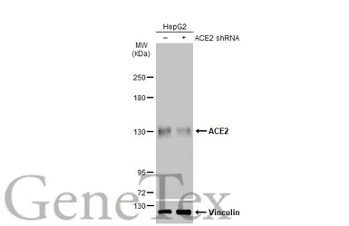 Anti-ACE2 antibody [N1N2], N-term used in Western Blot (WB). GTX101395