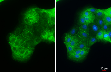 Anti-ACE2 antibody [N1N2], N-term used in Immunocytochemistry/ Immunofluorescence (ICC/IF). GTX101395