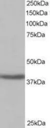 Anti-SIRT4 antibody used in Western Blot (WB). GTX10140