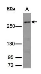 Anti-CAD antibody [C2C3], C-term used in Western Blot (WB). GTX101401