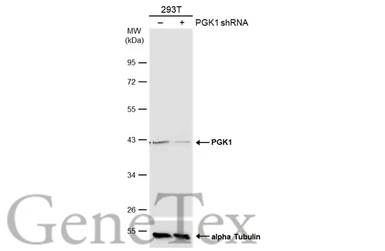 Anti-PGK1 antibody [N1C1] used in Western Blot (WB). GTX101405