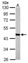 Anti-PGK1 antibody [N1C1] used in Western Blot (WB). GTX101405