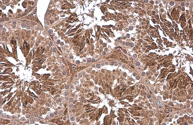 Anti-PGK1 antibody [N1C1] used in IHC (Paraffin sections) (IHC-P). GTX101405