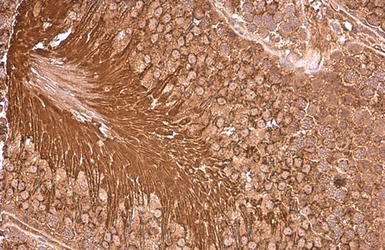 Anti-PGK1 antibody [N1C1] used in IHC (Paraffin sections) (IHC-P). GTX101405