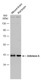 Anti-Aldolase A antibody used in Western Blot (WB). GTX101408