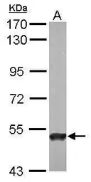 Anti-ABAT antibody used in Western Blot (WB). GTX101413