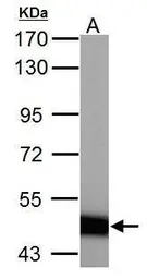 Anti-ABAT antibody used in Western Blot (WB). GTX101413