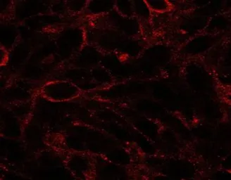 Anti-Dispatched A antibody, C-term used in Immunocytochemistry/ Immunofluorescence (ICC/IF). GTX10142