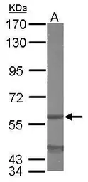 Anti-EIF3D antibody used in Western Blot (WB). GTX101424