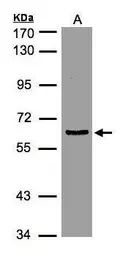 Anti-EIF3D antibody used in Western Blot (WB). GTX101424