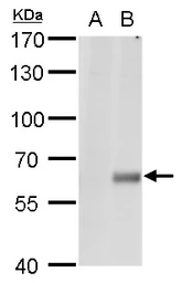 Anti-Copine 1 antibody [N1N3] used in Western Blot (WB). GTX101425