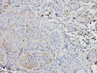 Anti-A-RAF antibody [C1C3] used in IHC (Paraffin sections) (IHC-P). GTX101427