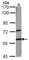 Anti-A-RAF antibody [C1C3] used in Western Blot (WB). GTX101427