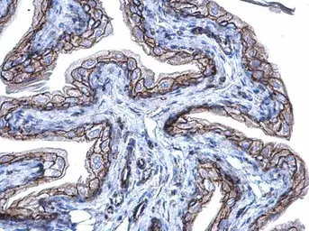 Anti-beta Catenin antibody [N1N2-2], N-term used in IHC (Paraffin sections) (IHC-P). GTX101435