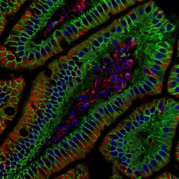 Anti-beta Catenin antibody [N1N2-2], N-term used in IHC (Paraffin sections) (IHC-P). GTX101435